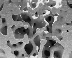 Obr. 23: Ukázka vnitřní komůrkovité struktury, vytištěno na TU Mnichov technologií 3D tisku spojováním prášku, Německo,